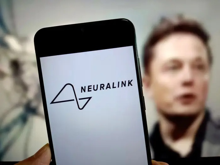 Elon Musk cho biết bệnh nhân đầu tiên cấy chip của Neuralink đang hồi phục tốt. Ảnh: Future Publishing.